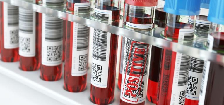 Ozonoterapia Ozonoterapia